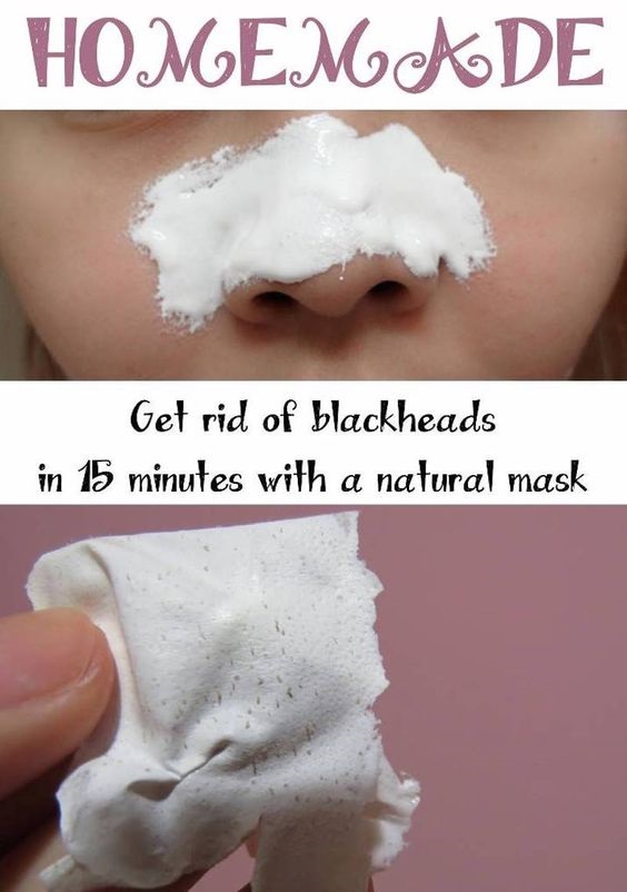 DIY Nose Strips To Get Rid Of Blackheads How To Beauty