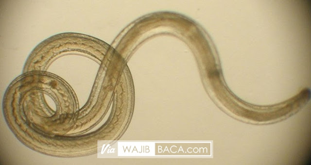 Inilah Akibatnya Jika Anda Terkena Cacing Parasit Inilah Akibatnya Jika Anda Terkena Cacing Parasit