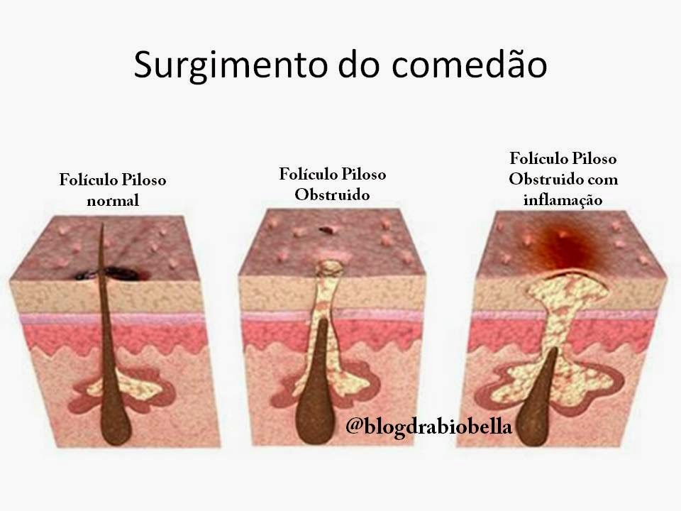 Blog Dra. BioBella março 2015