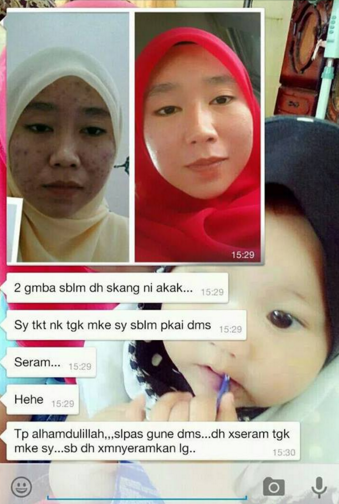testimoni dermax superskin 360