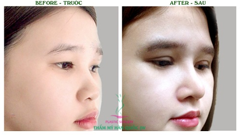 [Image: filler15.PNG]