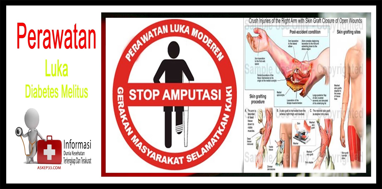 leaflet diabetes melitus wood scribd indo