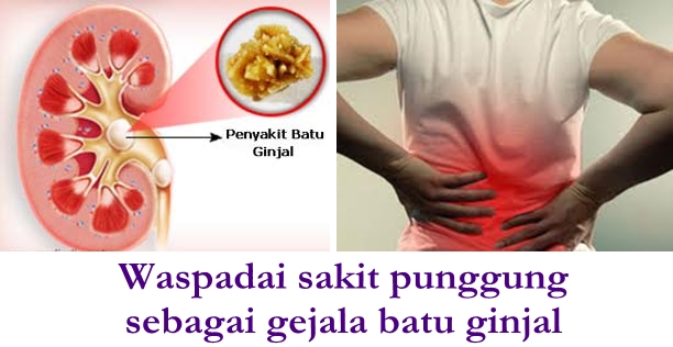 saung herbal Obat Untuk Gejala Batu Ginjal Dan Kencing