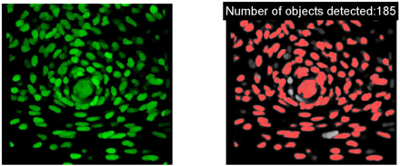 Basic cell counting and segmentation in Matlab