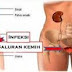 Cara mudah Mengobati terasa nyeri saat kencing pada tetesan terakhir