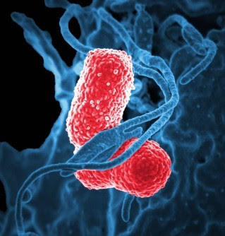 Pneumonia virus Makiung Pneumonia Vaccine Afforable