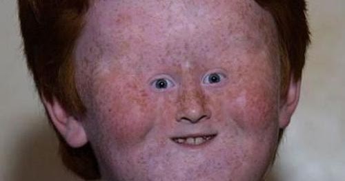 Ugly People - worlds ugliest People: Ugly People - most worlds ugliest