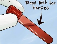 Herpes Testing
