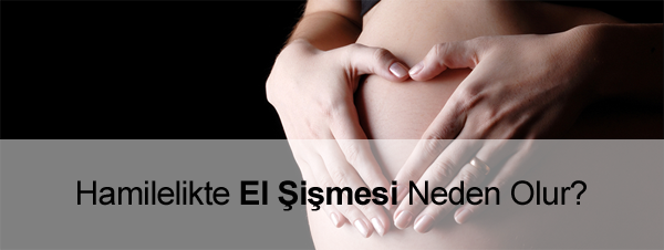 Hamilelikte El Şişmesi Neden Olur? hamilelikte el şişmesi neden olur?