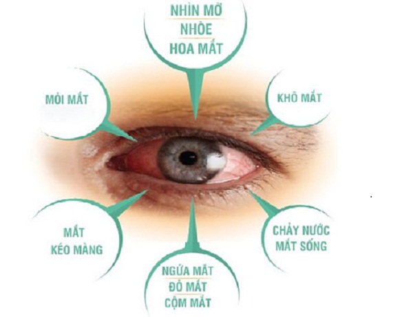 Bệnh Về Mắt Những Triệu Chứng Cảnh Bao Bệnh Về Mắt Nguy Hiểm Nặng