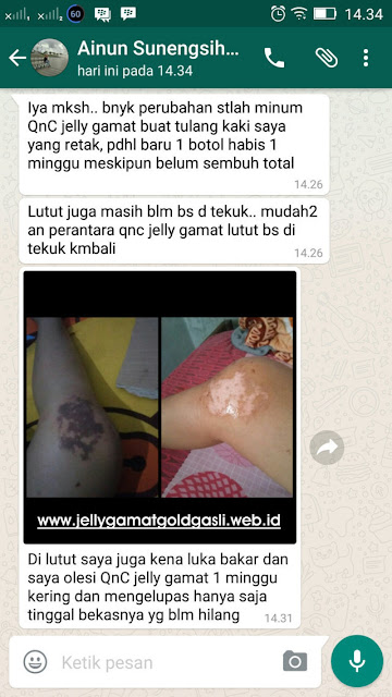 Salep Obat Luka Bakar Oles Di Apotik Salep Obat Luka Bakar Oles Di Apotik