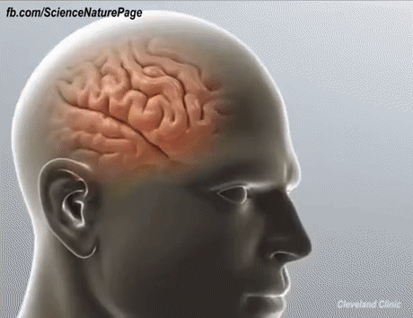 뇌종양 수술 2가지 방법