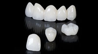 sample photo of 3m lava classic dental crown crown and bridge of 3m lava classic