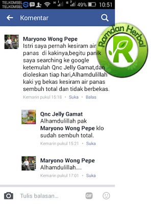Cara Mengobati Bekas Luka Tersiram Air Panas
