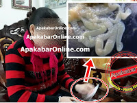 Sering Makan Daging Babi saat Jadi TKW di Hongkong, Cacing Pita Berkembang Biak di Perut Wanita Ini Sering Makan Daging Babi saat Jadi TKW di Hongkong, Cacing Pita Berkembang Biak di Perut Wanita Ini