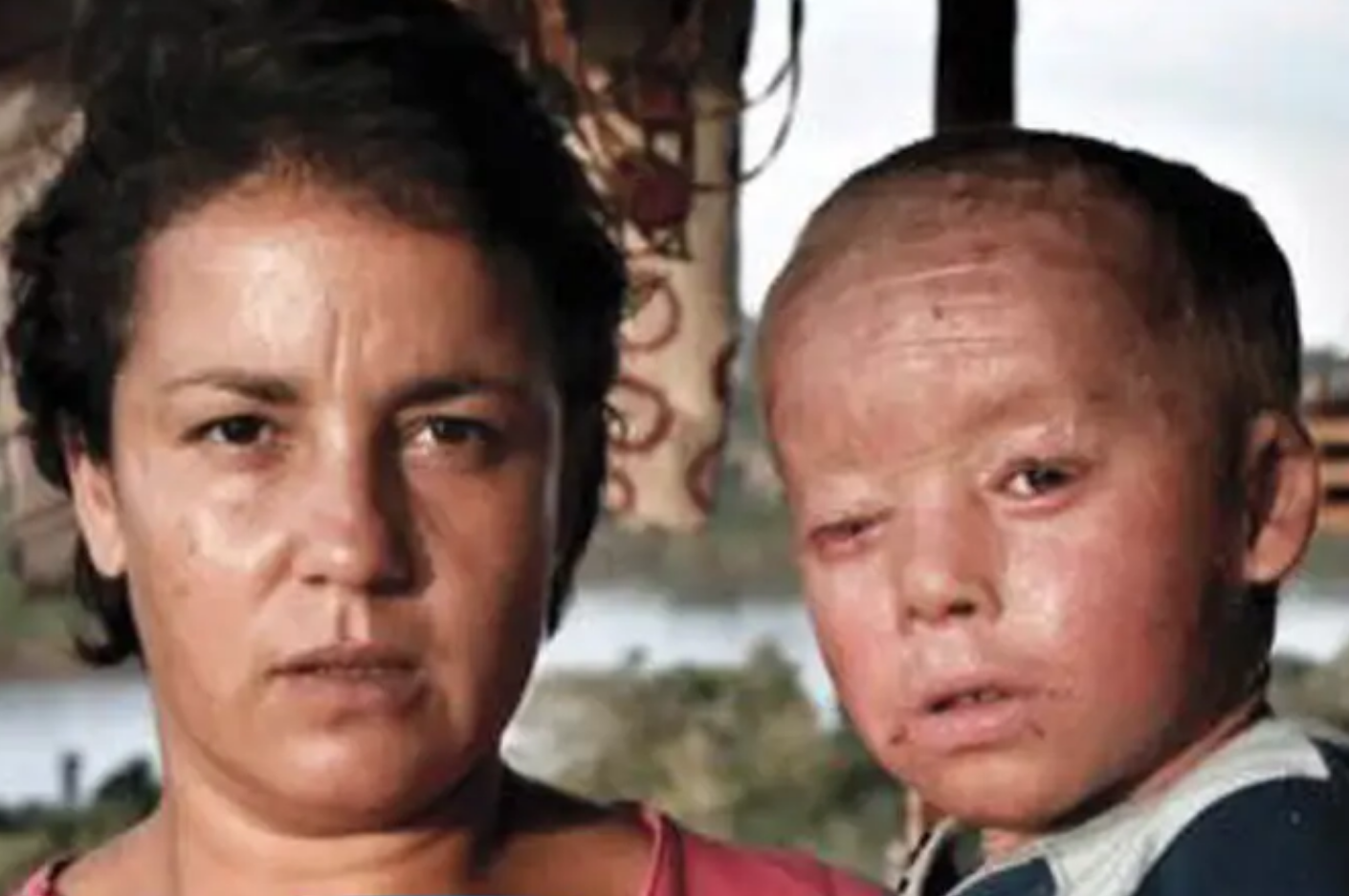 Crianças Geneticamente Modificadas O glifosato é o ingrediente ativo do herbicida Roundup. A maioria das pessoas acredita que o glifosato é praticamente não-tóxico para os seres humanos, em parte porque os a Monsanto gasta milhões com lobby, e com a mídia
