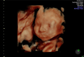 4D scan picture of Rumer at 24 weeks