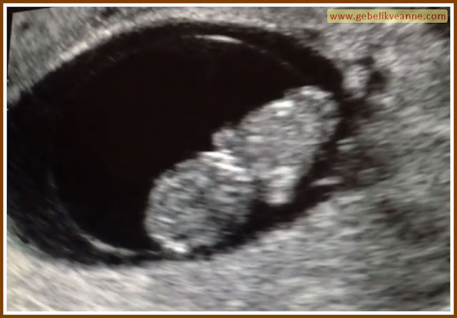 9 hafta 6 günlük bebek görüntüsü