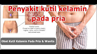 Obat Oles Kutil Kelamin di Apotek yang Tidak Panas dan Perih, harga obat podophyllotoxin di apotik, harga obat kutil kelamin di apotik