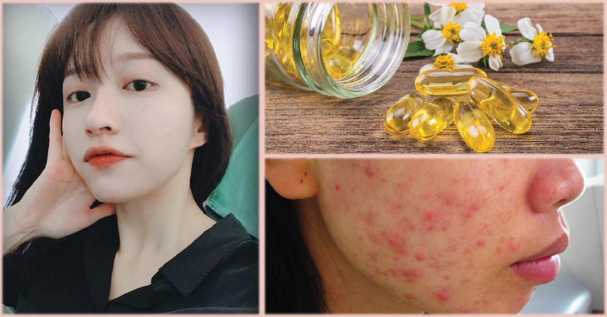 Bôi vitamin E giúp dưỡng da boi-vitamin-e-giup-duong-da