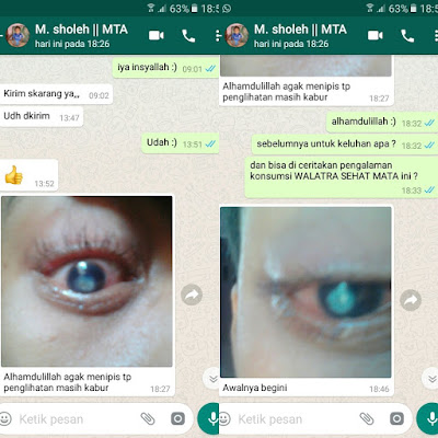 Cara Menghilangkan Bintik Putih Di Kornea Mata Sampai Tuntas Cara Menghilangkan Bintik Putih Di Kornea Mata Sampai Tuntas