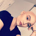 Photos: "I think I look good" Cancer patient embraces her bald hair