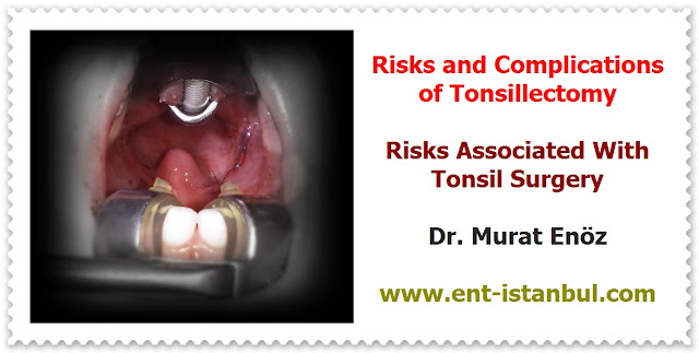 Tonsillectomy in Istanbul - Tonsillectomy Indiciations - Tonsillectomy Contraindications - Tonsillectomy Risks and Complications - Tonsillectomy Techniques - Surgical Procedure - Postoperative Patient Care After Tonsillectomy Operation - Tonsil Removal in Istanbul - Bloodless Tonsillectomy - Thermal Welding Tonsillectomy