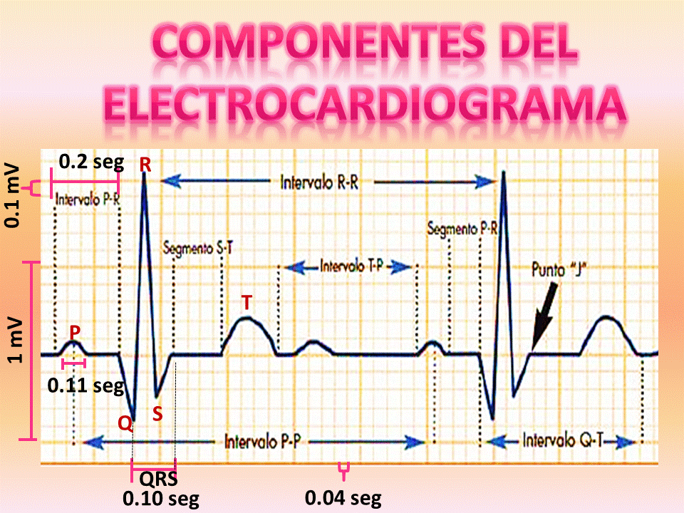 Electrocardiograma Ecg Normal Valores Y Ondas Normales | My XXX Hot Girl