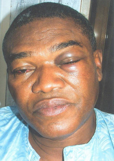buhari campaign manager attacked by sss buhari campaign manager attacked by sss