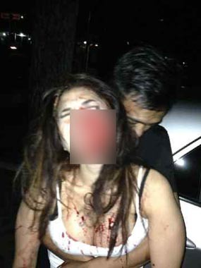 Ini Foto Nikita Mirzani Babak Belur Berlumuran Darah