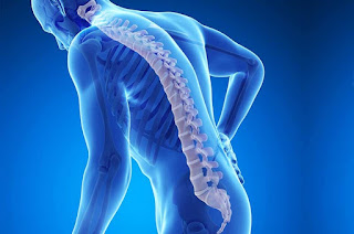OSTEOPOROSIS OSTEOPOROSIS