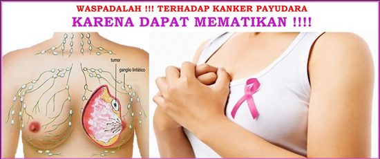 Kanker payudara pada wanita, obat kanker payudara apa, pengobatan kemoterapi pada kanker payudara, mengobati kanker payudara dengan pijatan, jus buah untuk mengobati kanker payudara, obat alami untuk mengatasi kanker payudara, kanker payudara stadium 4 sembuh, obat kangker payudara secara alami, cara menyembuhkan kanker payudara dengan obat alami, apa obat kanker payudara secara alami, informasi kanker payudara lengkap