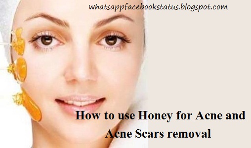 Health is Wealth: How to use Honey For Acne