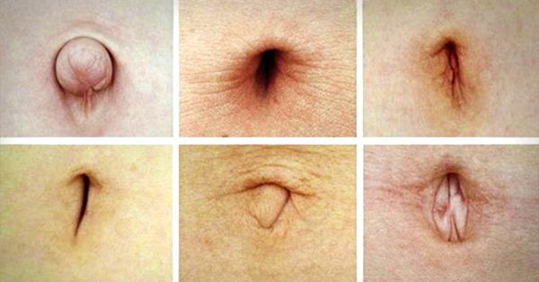 Take A Closer Look At Your Belly Button, If Yours Look Like This, Then You Better Read This Now!