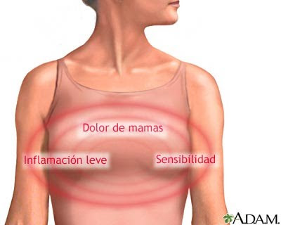 Dolor leve en los senos