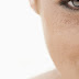 Remove Skin Pigmentation on Face Beauty Tips