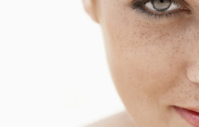 Remove Skin Pigmentation on Face Beauty Tips Remove Skin Pigmentation on Face Beauty Tips