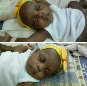 1 Photos: Conjoined Ayeni Twins arrive New York for surgery