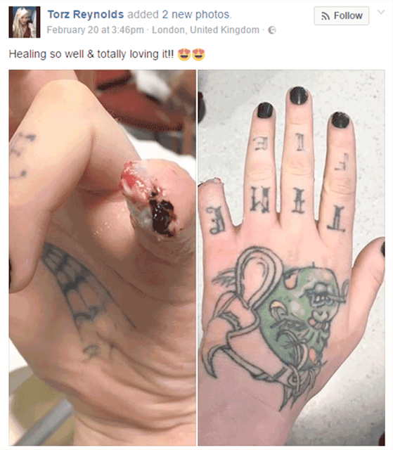 Crazy Girl Chop3 WTF? Woman cuts her pinky finger live on social media...