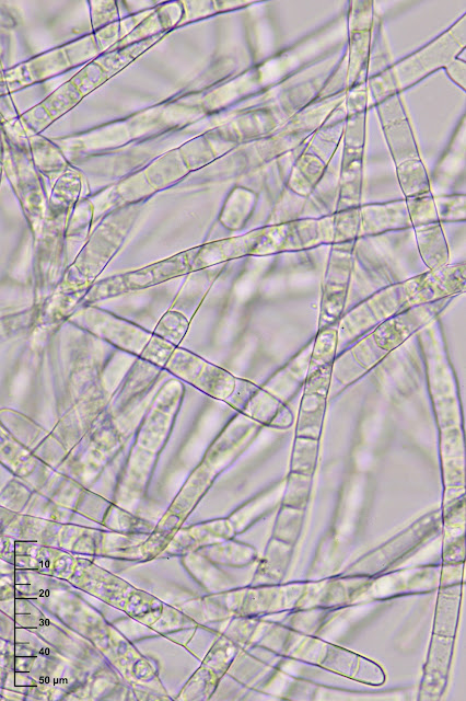 Hymenoscyphus varicosporoides