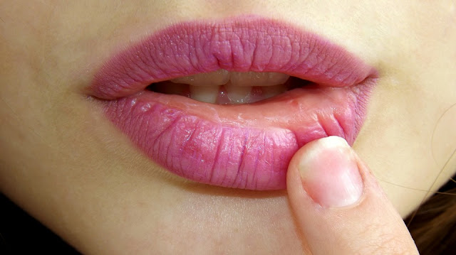 10 Best Home Remedies For Dry And Chapped Lips Chapped Lips, Dry Lips, How To Get Rid Of Chapped Lips, How To Get Rid Of Dry Lips, How To Cure Chapped Lips, Chapped Lips Remedy, Home Remedies For Chapped Lips, How To Treat Chapped Lips, Chapped Lips Treatment, Chapped Lips Home Remedies, Remedy For Chapped Lips, Cure Chapped Lips,