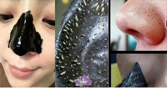 ¿Cómo eliminar los puntos negros de manera rápida y ...