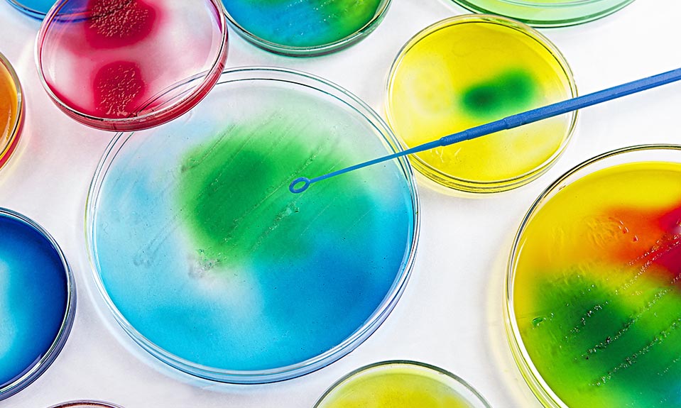 Faktor Yang Mempengaruhi Pertumbuhan Mikroorgansime Generasi Biologi