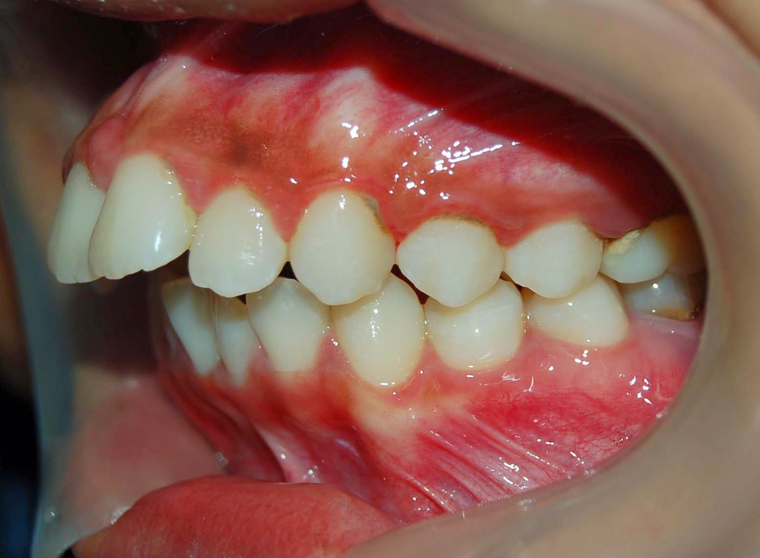 Odontolog a usat maloclusiones