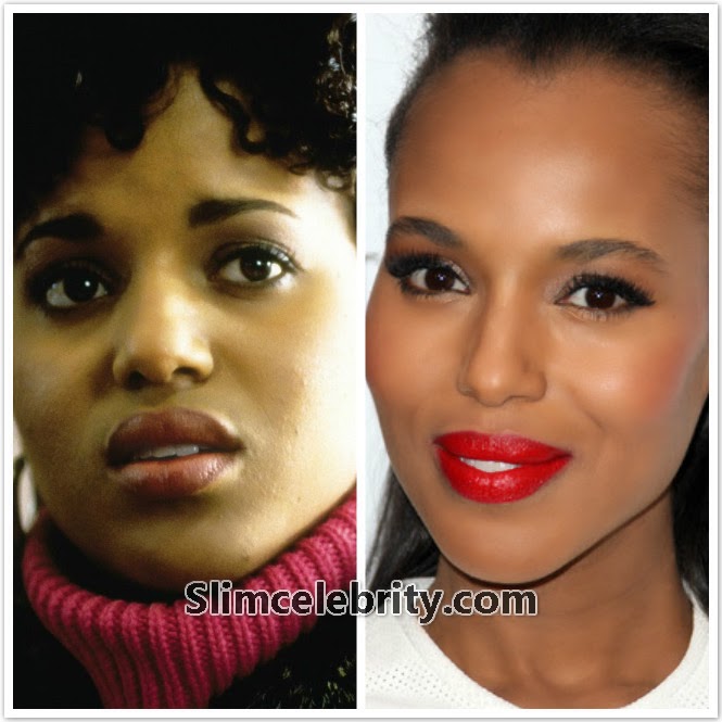 The Best Female Celebrity Plastic Surgery Transformations The Best Female Celebrity Plastic Surgery Transformations