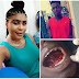 Disturbing photo: Lady allegedly chops off neighbor’s tongue for rituals