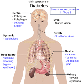 Insulin and Diabetes Militus Insulin and Diabetes Militus