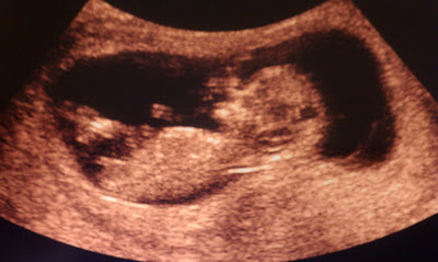 Just Married Real Estate: The Blog