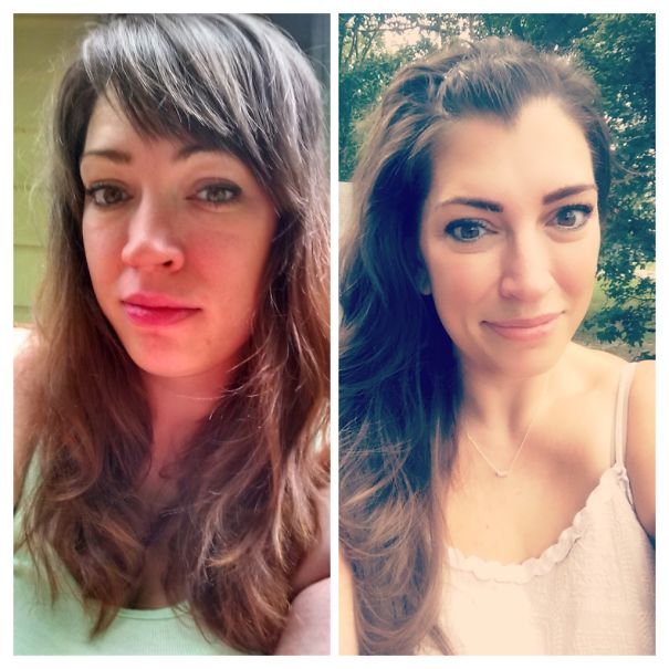 10+ Before-And-After Pics Show What Happens When You Stop Drinking - 1 Year Sober Before And After