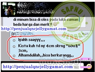 Obat Penghancur Kista, TERBUKTI MUJARAB Mengobati Kista Sampai Sembuh Obat Penghancur Kista, TERBUKTI MUJARAB Mengobati Kista Sampai Sembuh